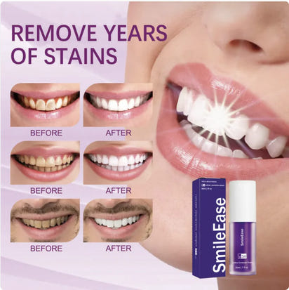 V34 Whitening Toothpaste