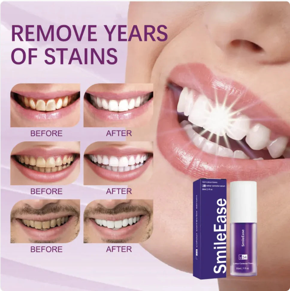 V34 Whitening Toothpaste